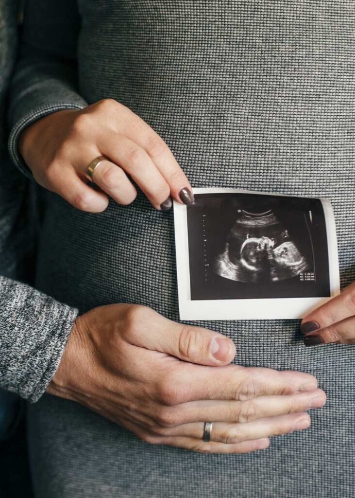 Fertility Acupuncture